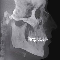 Kopfröntgenaufnahme in 3D